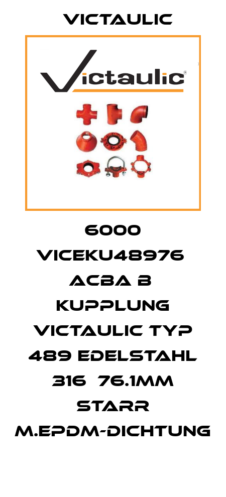 6000 VICEKU48976  ACBA B  Kupplung Victaulic Typ 489 Edelstahl 316  76.1mm starr m.EPDM-Dichtung Victaulic